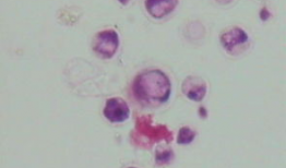 脑膜刺激征检查视频,直观解析临床诊断技巧